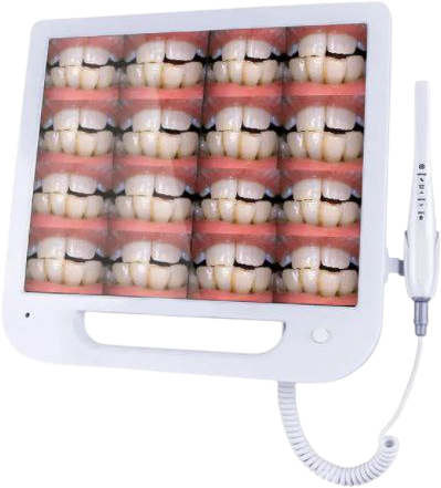 Cámara Intraoral Roson DA100 WiFi